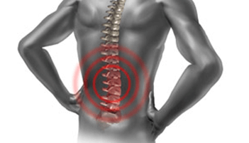 Back Pain Treatment without Surgery in Ahmadabad