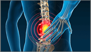 Spine Surgery