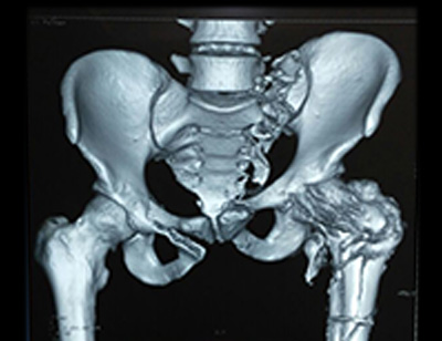 Orthopaedic Surgeon in Ahmedabad Orthopaedic Surgeon in Ahmedabad